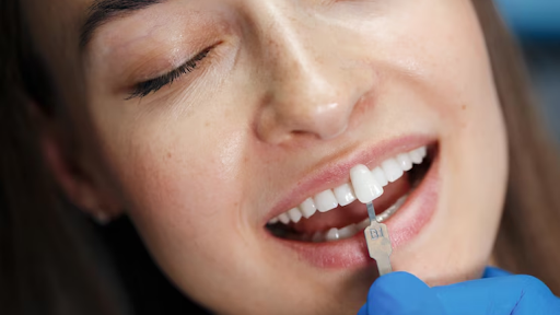 Does Professional Whitening at Home Match the Dentist’s Chair?