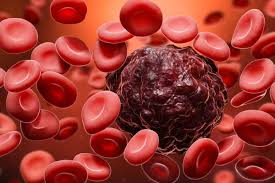 CAR-T Cell Therapy: Transforming Blood Cancer Treatment Landscape