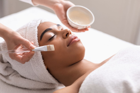 chemical peel treatment