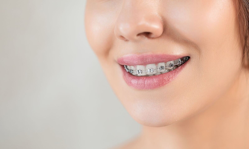 Adult Orthodontics: What Changes When Treatment Starts Later in Life